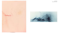 (Wolfgang Tillmans)(Serpentine Gallery)